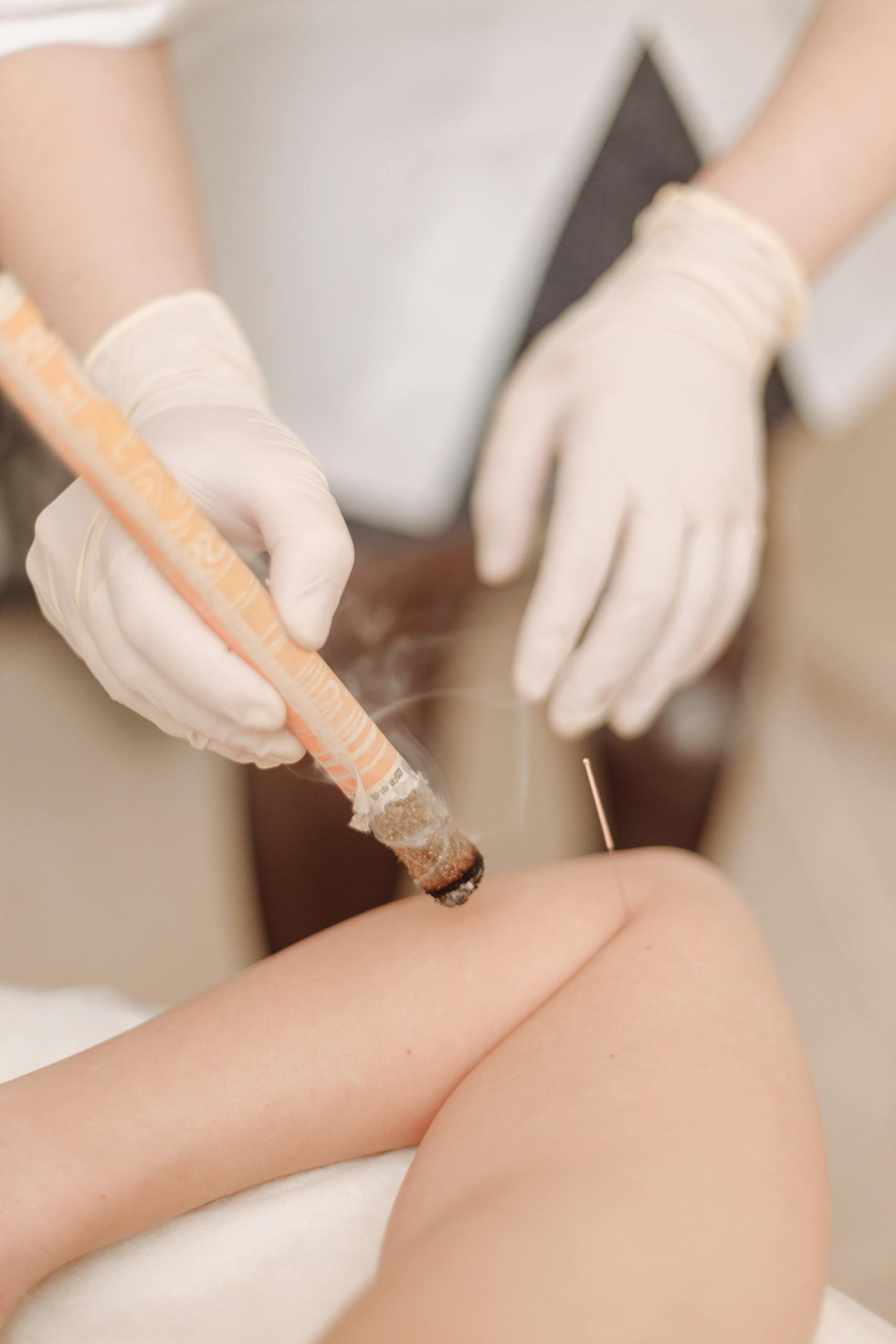 Needle Stuck on a Patient's Arm